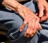 Parkinson Hastalarında Erken Teşhisin Önemi