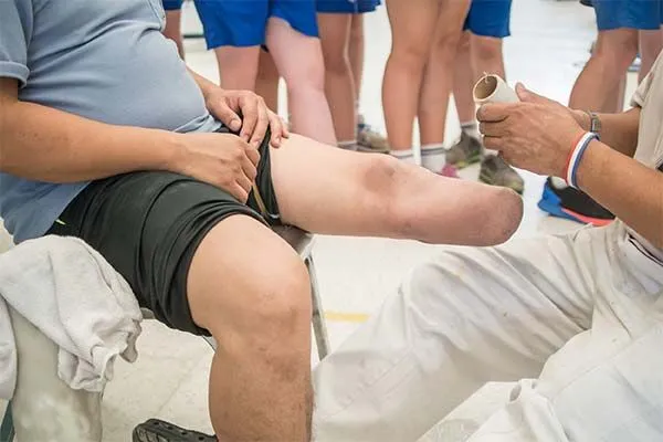 Ampute Hastalarda Protez Öncesi ve Sonrası Rehabilitasyon