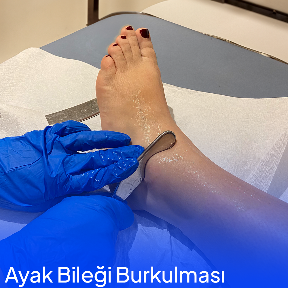 Ayak Bileği Burkulmalarında Fizik Tedavi