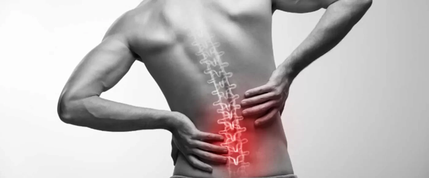 Bel Fıtığı Nedir? Nasıl Tedavi Edilir?