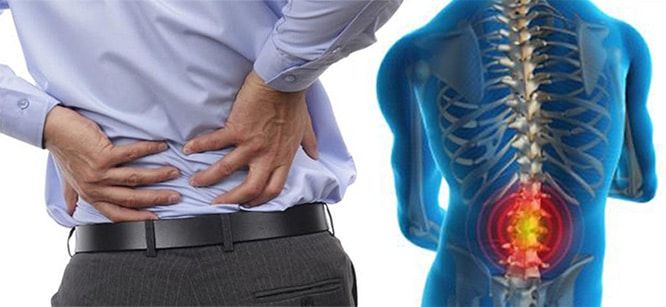 Bel Fıtığına Ne İyi Gelir?