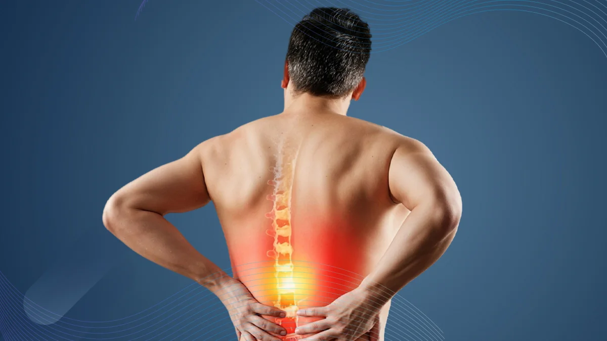 Bel Fıtığında Hareket Korkusu: Nedenleri ve Rehabilitasyondaki Önemi