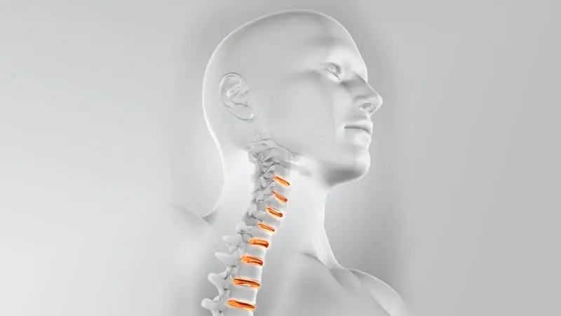 Boyun Düzleşmesi Nedir? Belirtileri ve Tedavi Yöntemleri