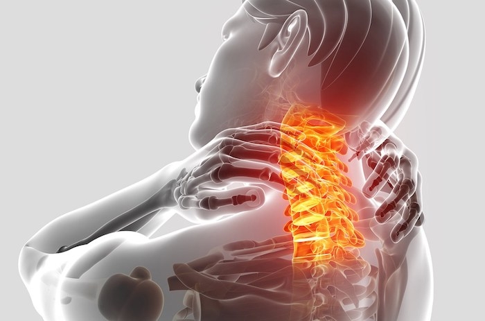 Boyun Fıtığı Egzersizle Tedavi Edilebilir Mi?