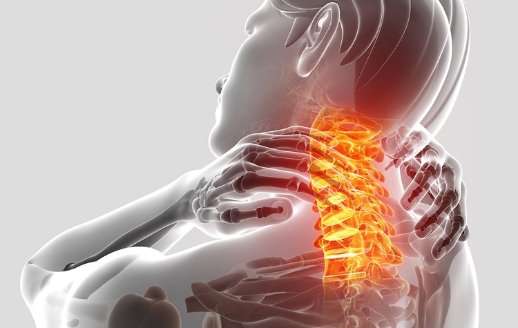 Boyun Fıtığında Fizik Tedavi: Ameliyat Gerekir Mi?