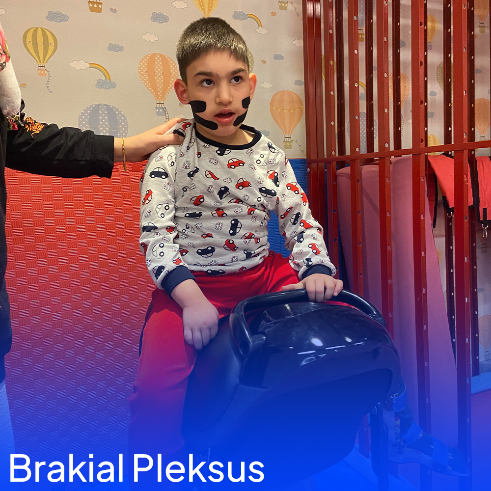 Brakial Pleksus Yaralanmaları ve Tedavi Yöntemleri