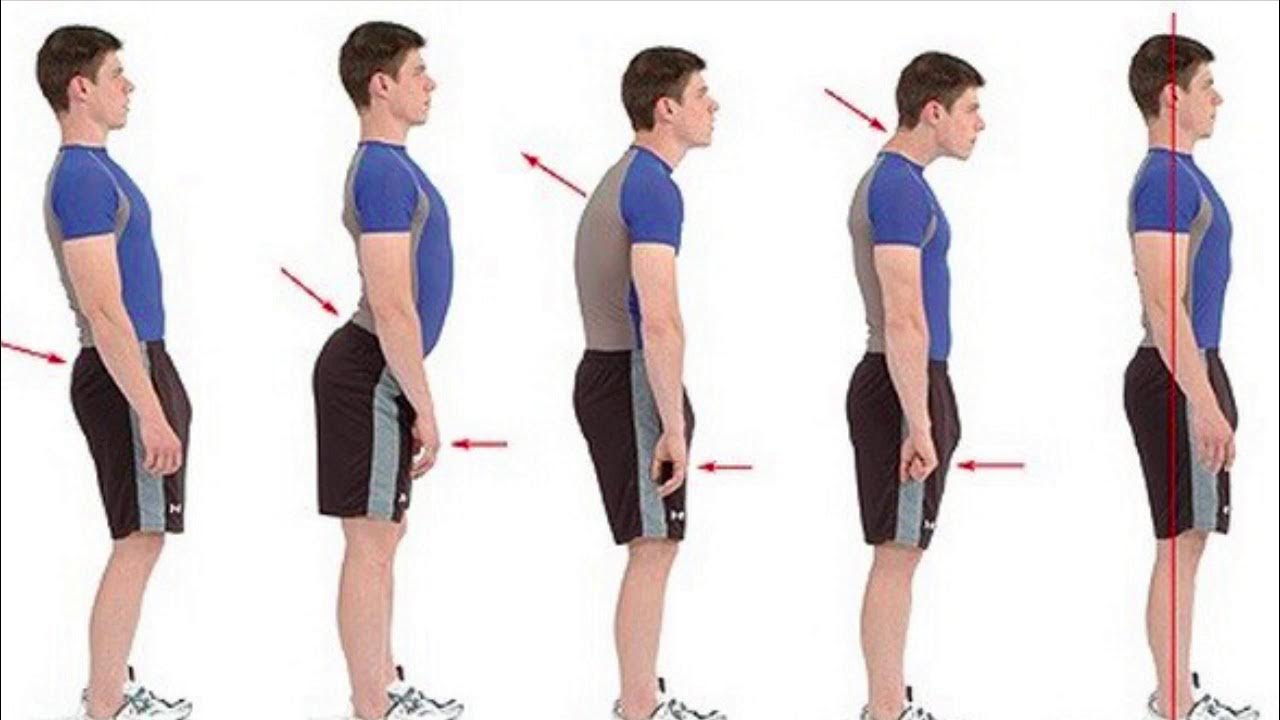 Çocuklarda Duruş Bozuklukları ve Fizik Tedavi