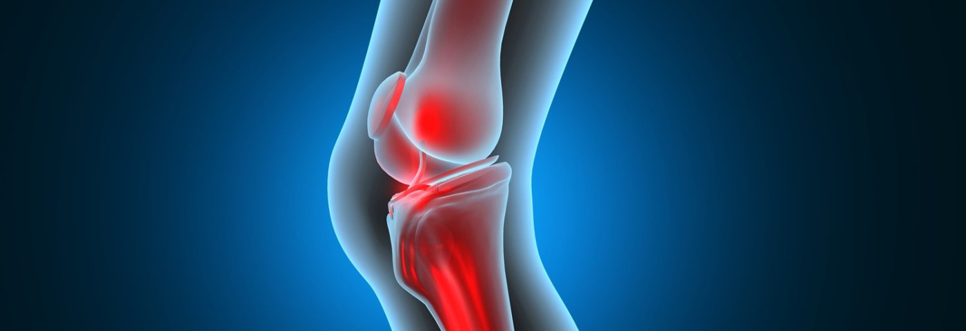 Diz Kireçlenmesi Olanlar İçin En Etkili Fizik Tedavi Yöntemleri