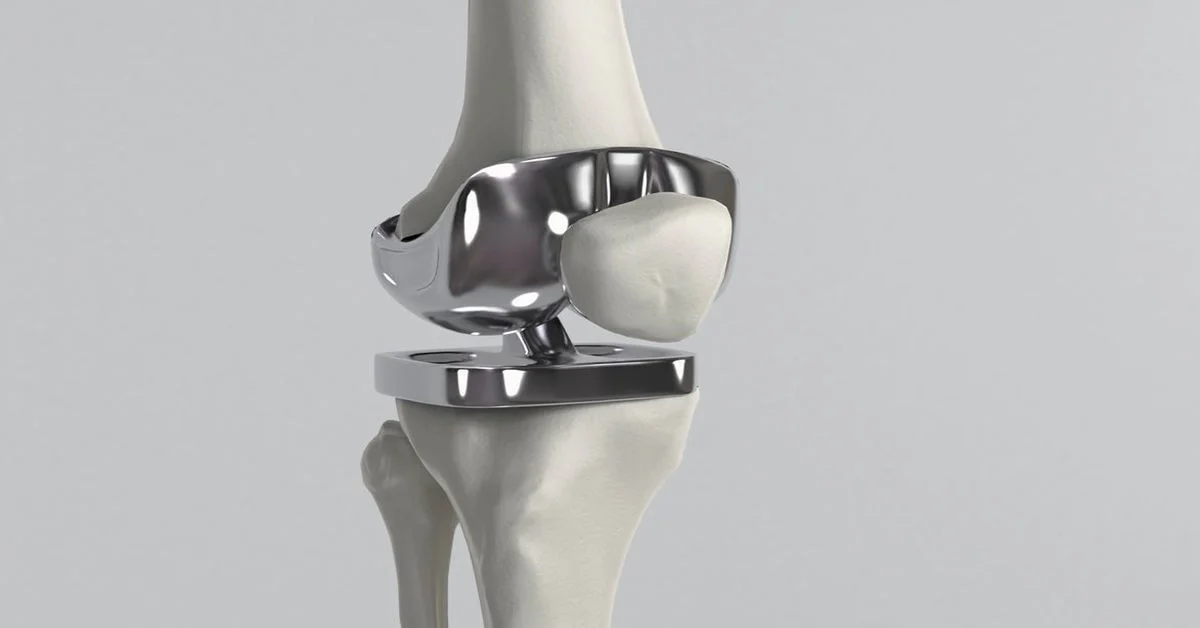 Diz Protezi Sonrası Hareket Özgürlüğünü Geri Kazanmak Mümkün mü?