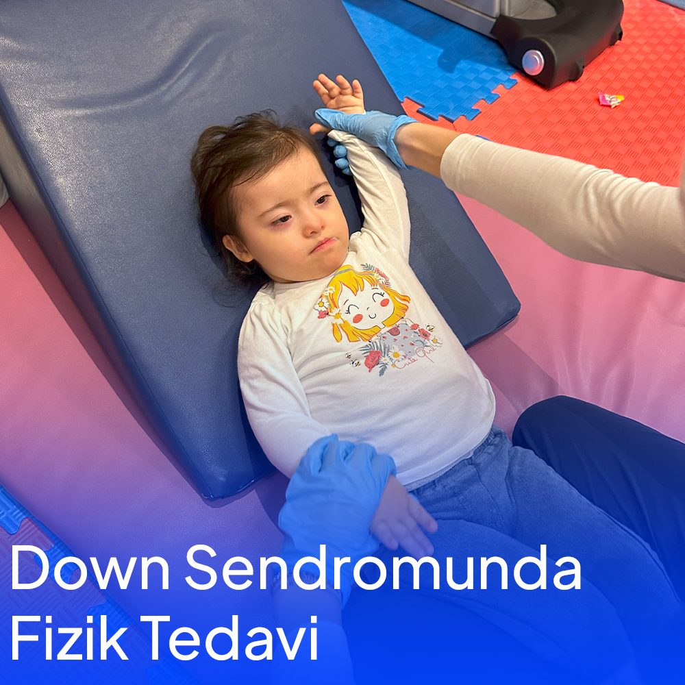 Down Sendromunda Fizik Tedavi