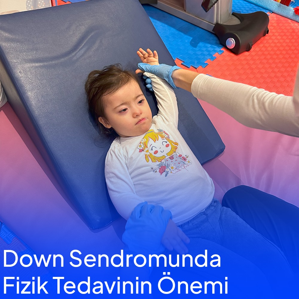 Down Sendromunda Fizik Tedavinin Önemi 