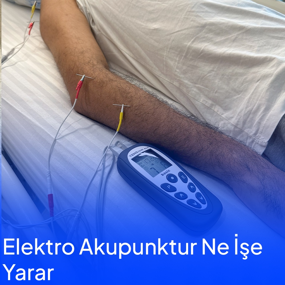 Elektroakupunktur ne işe yarar ?