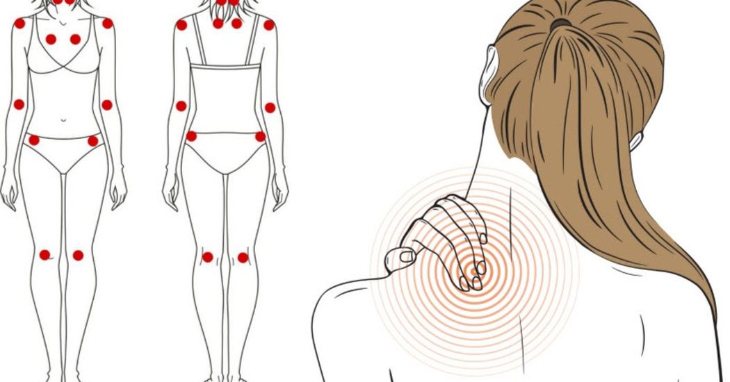 Fibromiyalji Sendromu: Tanı ve Tedavi Yöntemleri