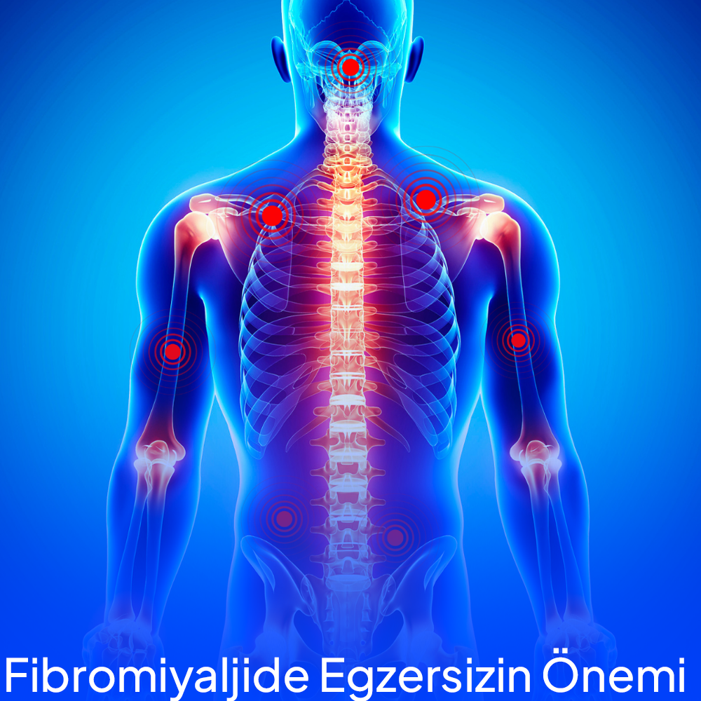 The Role of Exercise in Fibromyalgia Treatment