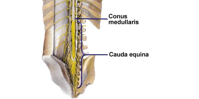 Kauda Equina Sendromu Belirtileri Nelerdir? Ne Zaman Tehlikelidir?