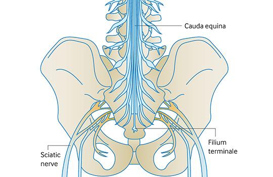 Kauda Equina Sendromu Nedir? Belirtileri, Tedavisi ve Fizik Tedavi Süreci