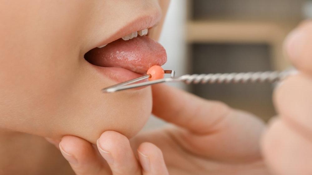 How to Treat Stuttering?