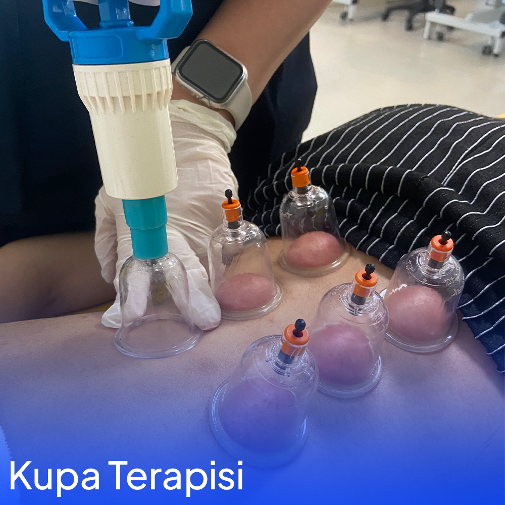 Effects of Cupping Therapy on Pain