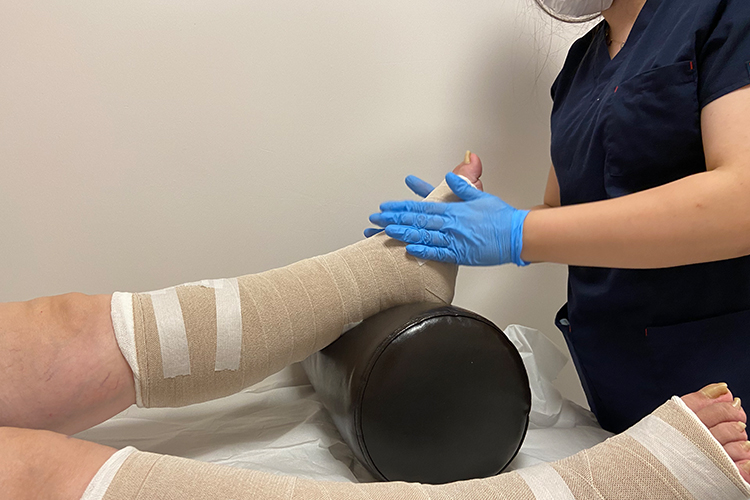 What is Lymphedema, How to Understand It, How to Treat It?