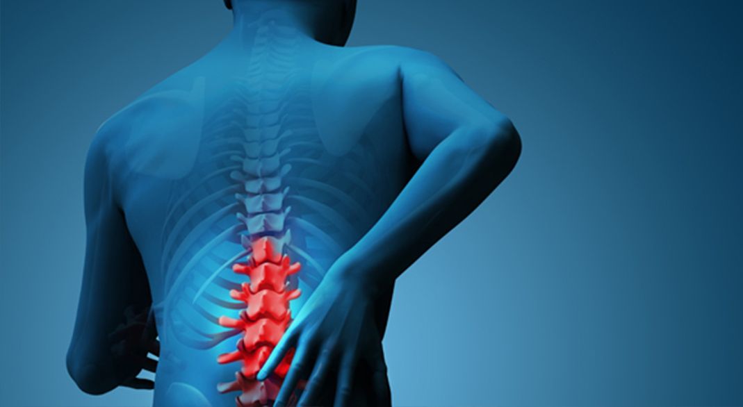 Lumbal Disk Hernisinde (Bel Fıtığı) Robotik Destekli Rehabilitasyon