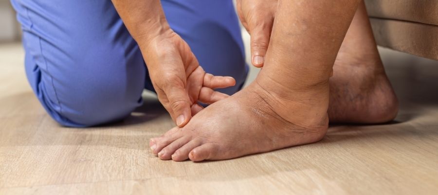 Meme Kanseri Sonrası Lenfödem Tedavisi