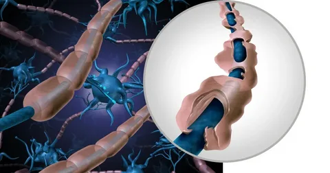 MS ve En Sık Sorulan 10 Soru