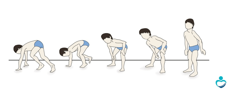 Musküler Distrofi Nedir? Tedavi Edilebilir mi?