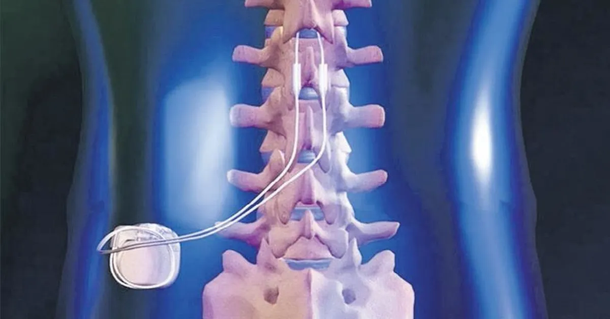 Omurilik Pili Takılan Hastalarda Fizik Tedavi