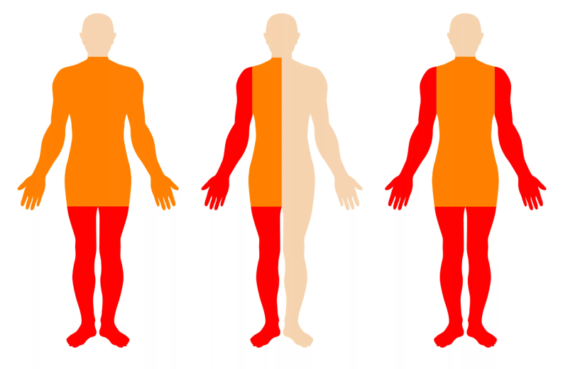 Omurilik Pili ve Parapleji’de Kullanımı