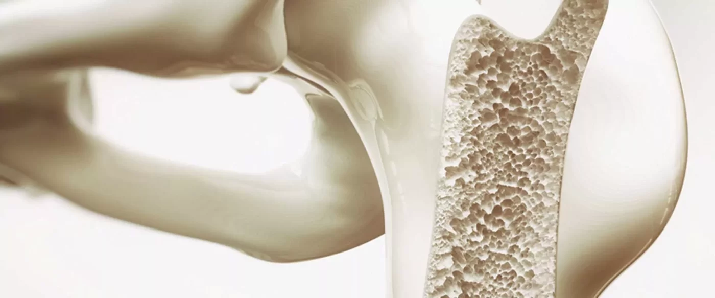 Osteoporoz Hastalarında Egzersizle Kırık Riskini Azaltmak