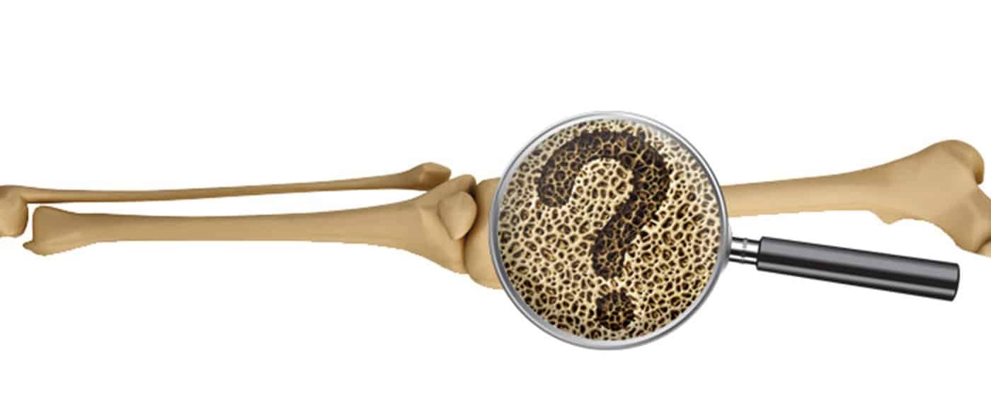 Osteoporozda Egzersiz Yaklaşımları ve Düşme Riskinin Azaltılması