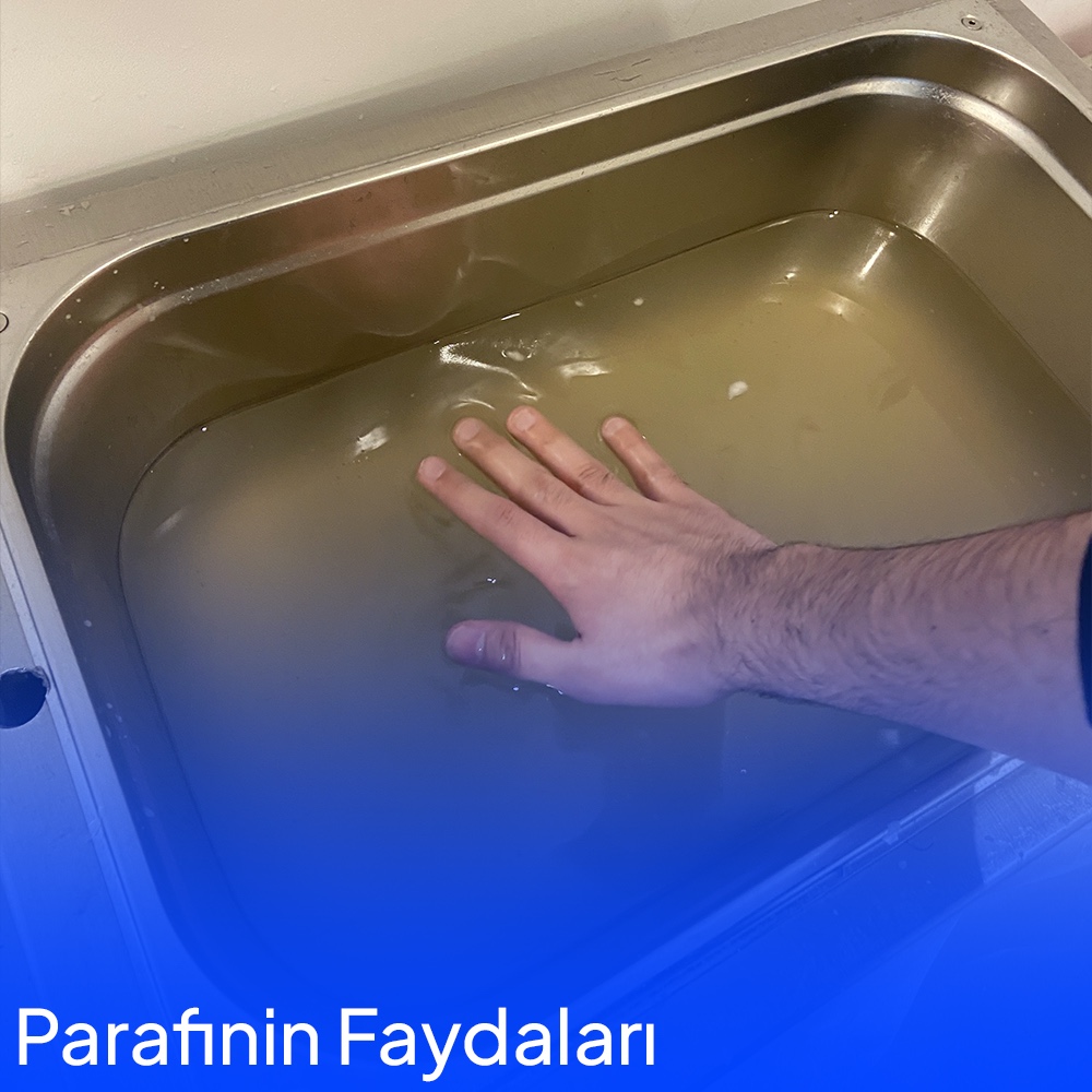 Benefits of Paraffin Applications in Physical Therapy