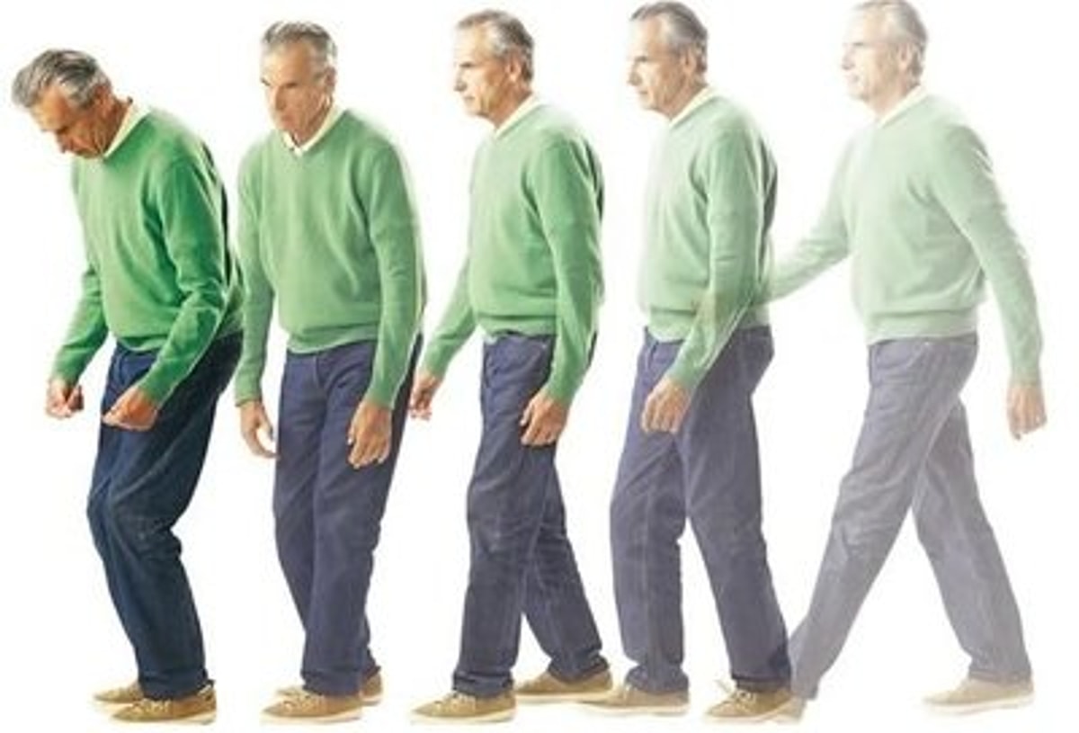 Parkinson Hastalarında Fizik Tedavinin Faydaları