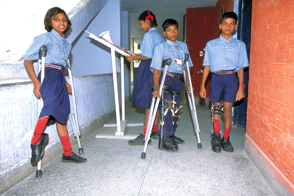 Poliomyelit Sekeli ve Fizyoterapi