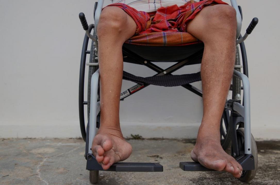 Poliomyelit Sekeli ve Robotik Rehabilitasyon