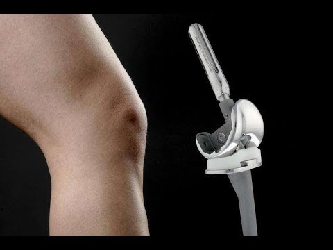 Protez Ameliyatı Sonrası Tekrar Yürüme