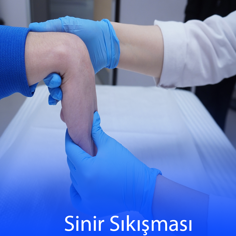 Nerve Compression and Treatment