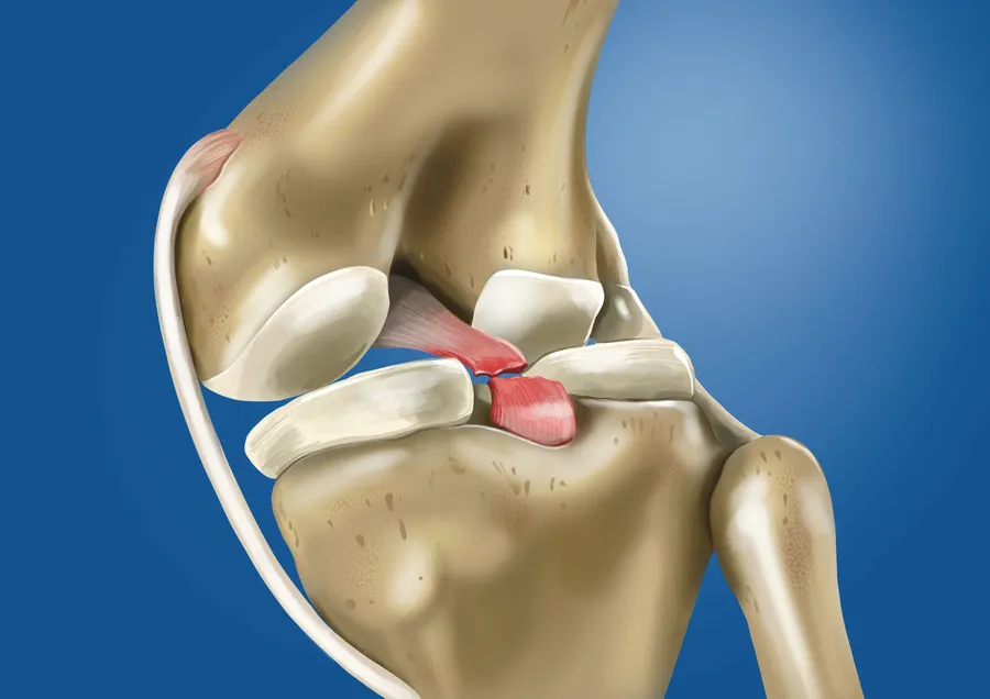 Spor Yaralanmalarında Hızlı ve Güvenli Geri Dönüş İçin Rehabilitasyon