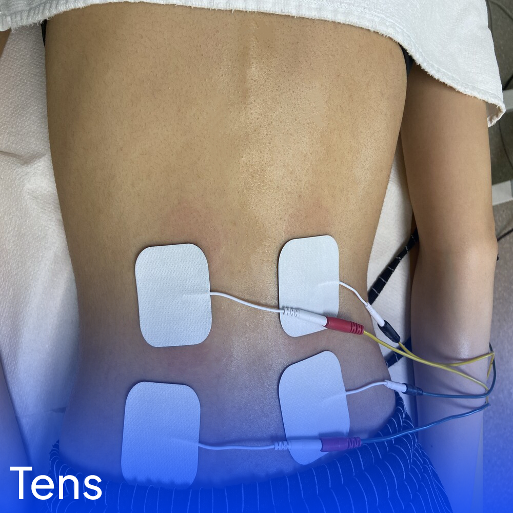 What is Tens Therapy?