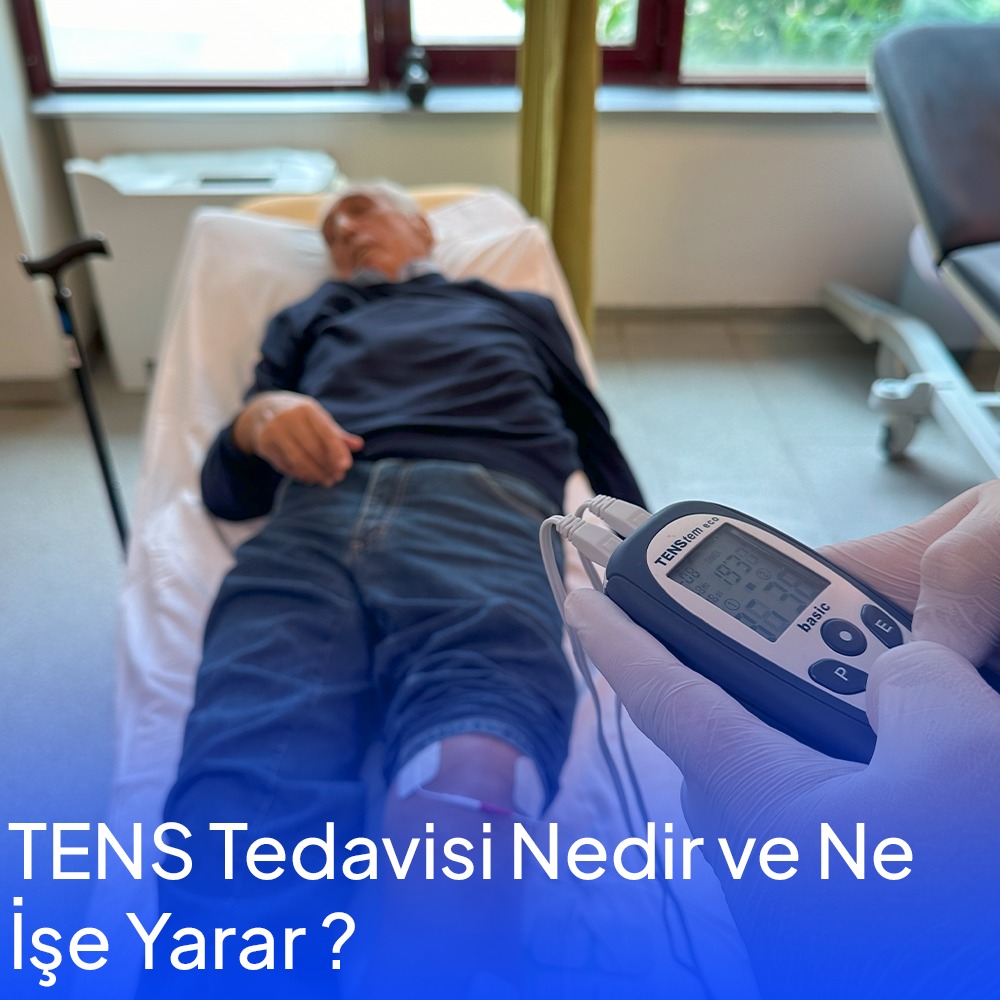 What is TENS Therapy and What Does It Do?