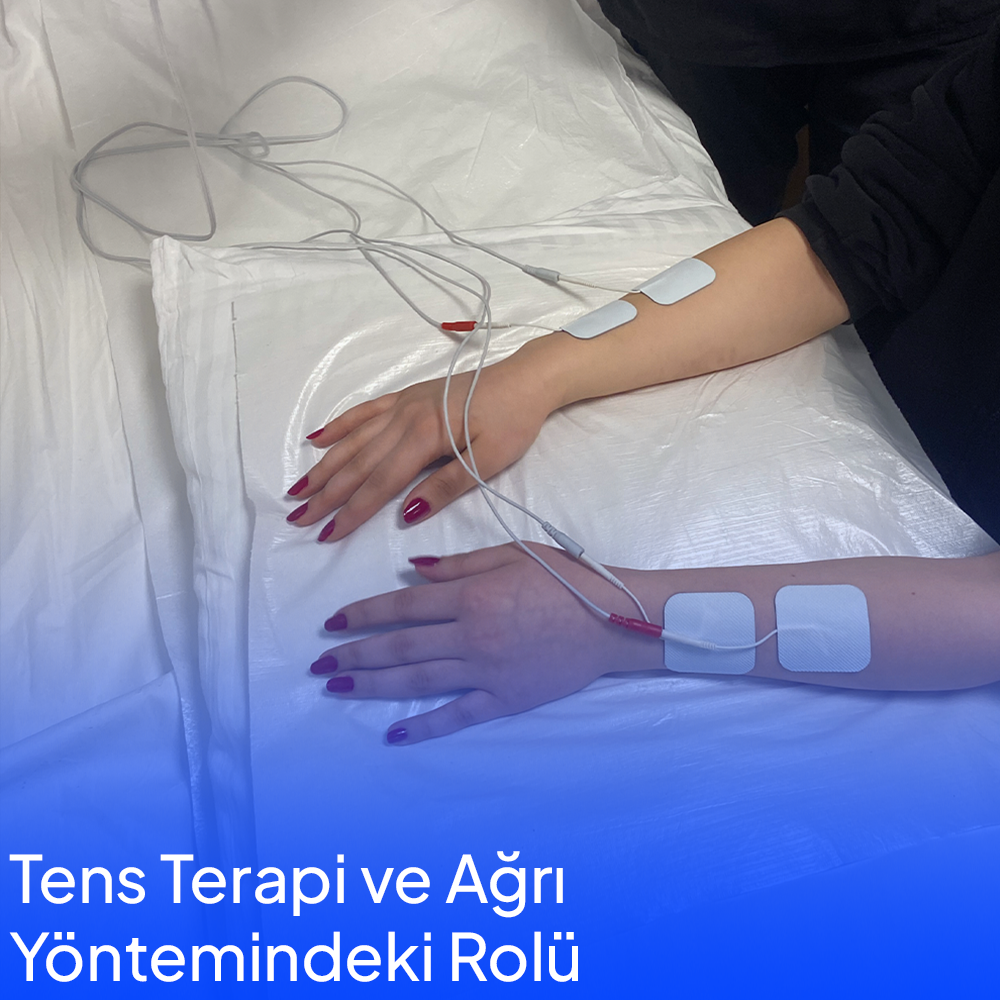 TENS Therapy and Its Role in Pain Management