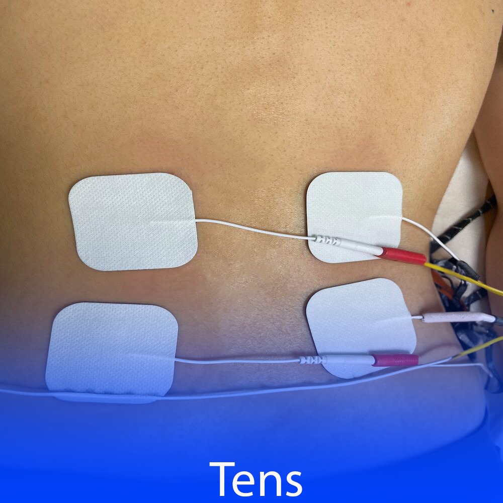 What is Tens (Transcutaneous Electrical Nerve Stimulation)?