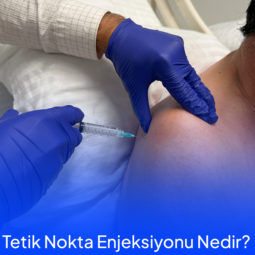 What is Trigger Point Injection?