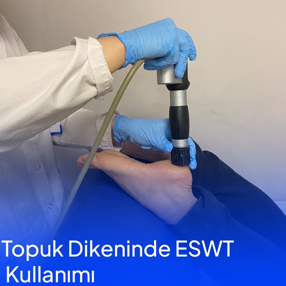 Topuk Dikeninde ESWT Nedir ?