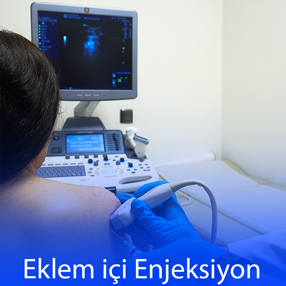 Ultrasound-Guided Intra-Articular Injection