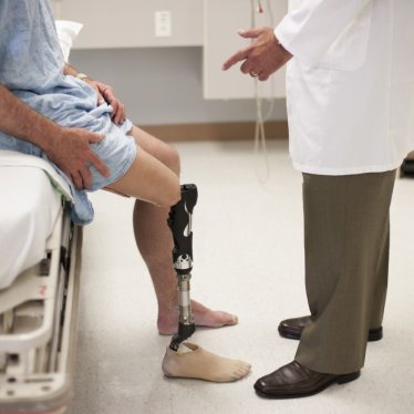 Amputasyon Sonrası Fizik Tedavi