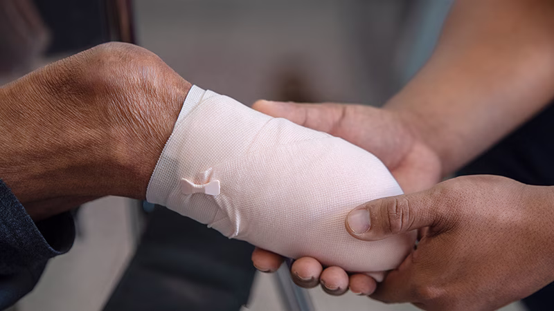 Ampütasyon Sonrası Fizik Tedavinin Önemi