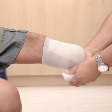 Amputasyon Sonrası Rehabilitasyon Süreci Nasıl İşler ?