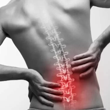 Bel Fıtığı Nedir? Nasıl Tedavi Edilir?