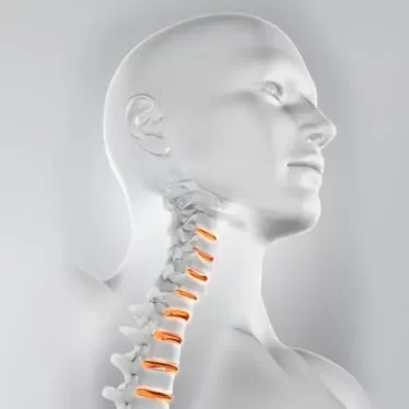 Boyun Düzleşmesi Nedir? Belirtileri ve Tedavi Yöntemleri